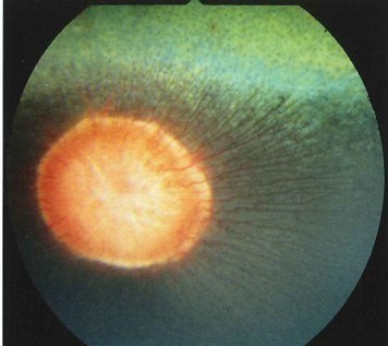 Normal ögonbotten häst