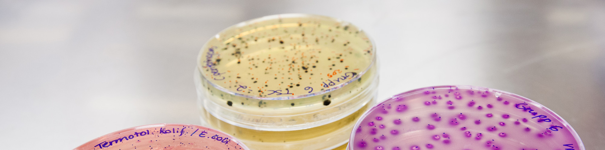 Petri dishes with bacterial culture. Photo.
