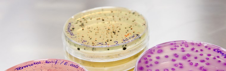 Petriskålar med bakterieodlingar. Foto.