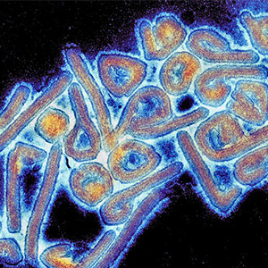 Micrograph of the Marburg virus